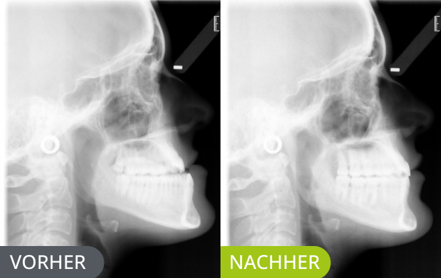 3D Planung